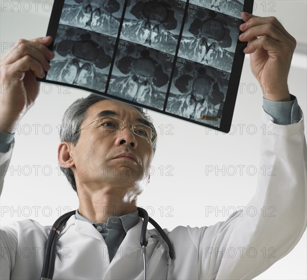 Male doctor looking at x-rays.