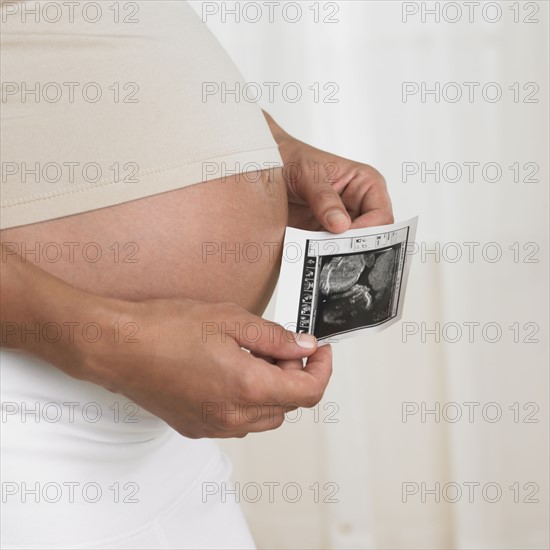 Pregnant woman holding ultrasound next to stomach.