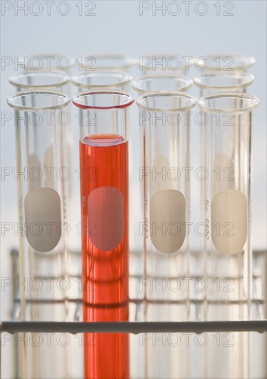 Close up of vials in tray .