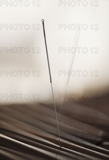 Close up of acupuncture needle.