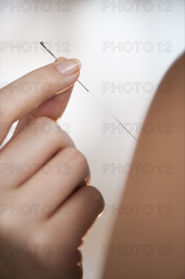 Hand holding accupuncture needles.