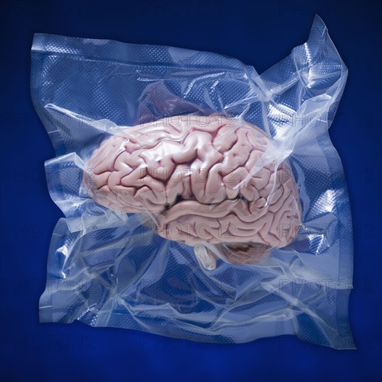 Shrink wrapped brain