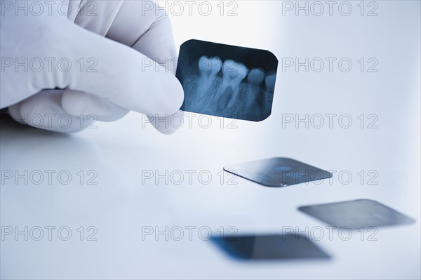 Dental x-ray.