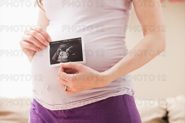 Young pregnant woman holding CT image of unborn baby. Photo : Mike Kemp
