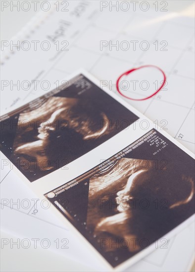 Sonogram picture and calendar with due date. Photo : Jamie Grill Photography