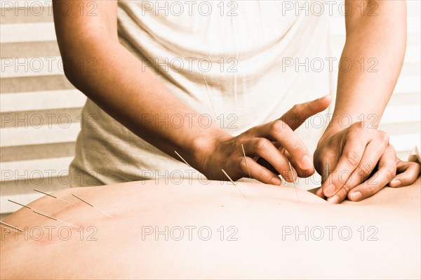 Nurse with acupuncture patient. Photo : Noah Clayton