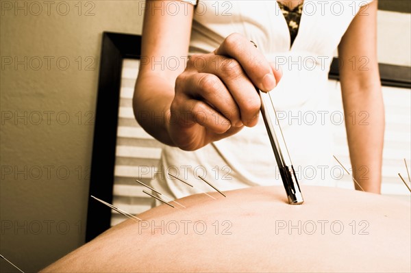 Nurse with acupuncture patient. Photo : Noah Clayton