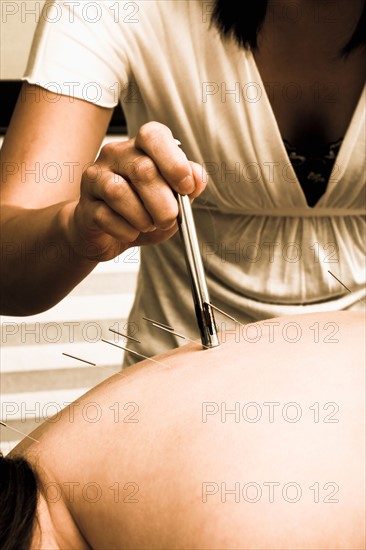 Nurse with acupuncture patient. Photo : Noah Clayton