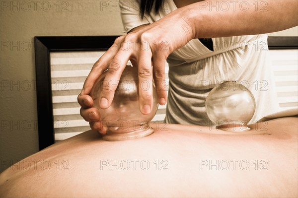 Nurse vacuum cupping patient. Photo : Noah Clayton