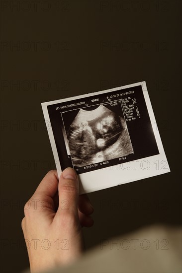 Woman holding ultrasonograph photo of baby. Photo : Rob Lewine