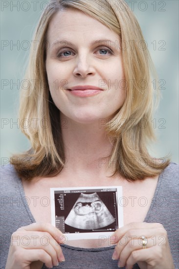 Pregnant woman holding CAT image of her belly. Photo : Rob Lewine