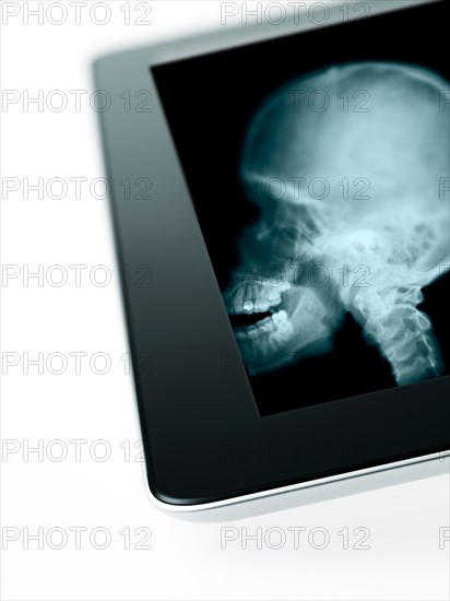 Studio shot of digital tablet with x-ray of human foot. Photo: David Arky