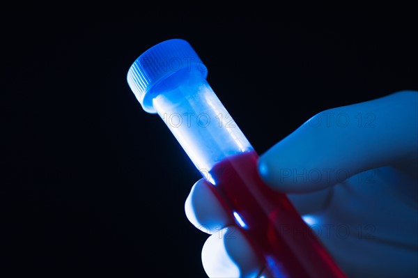 Studio shot of hand holding vial with blood.