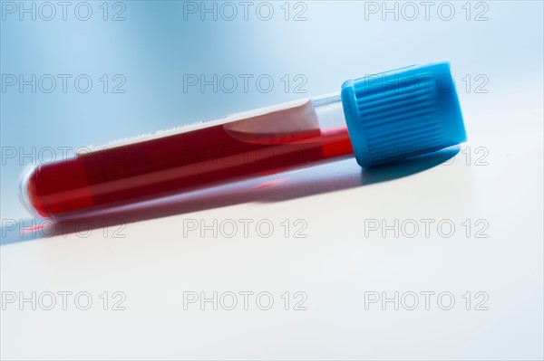 Studio shot of blood sample.