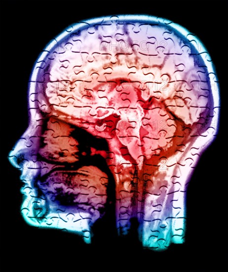 Conceptual image of human brain. 
Photo : Calysta Images