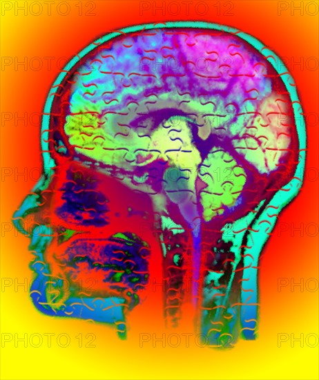 Conceptual image of human brain. 
Photo : Calysta Images