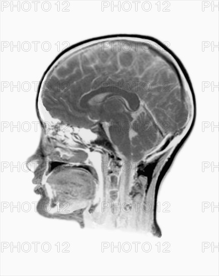 MRI Scan of human head. 
Photo: Calysta Images