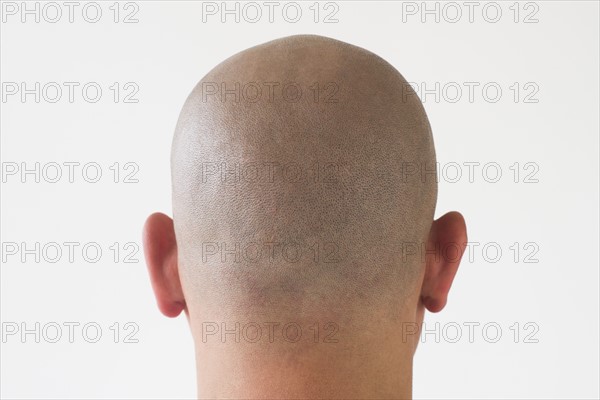 Back view of man with shaved head.