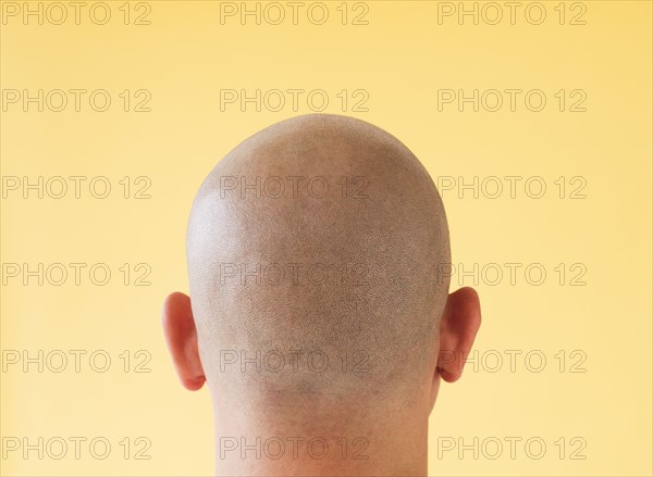 Studio shot of man's shaved head.