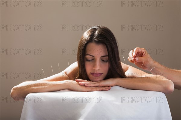 Close-up of woman with acupuncture needles in her arm and shoulders. Photo: Mike Kemp