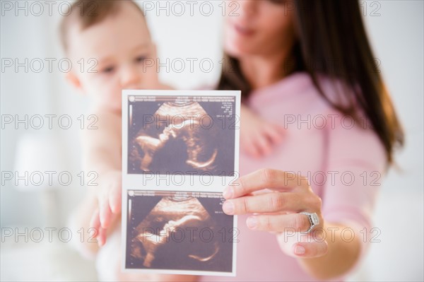 Mother with daughter (6-11 months) holding ultrasound scan