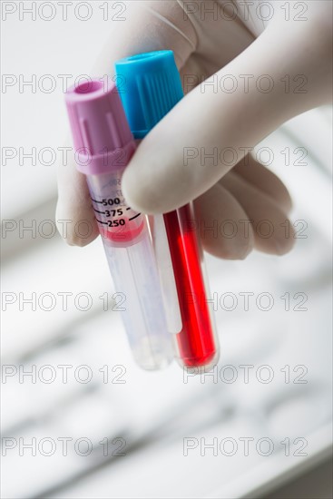 Close up of hand in surgical glove holding laboratory vials, studio shot.