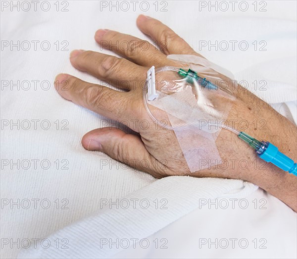 Close up of hand of elderly patient with IV drip attached.