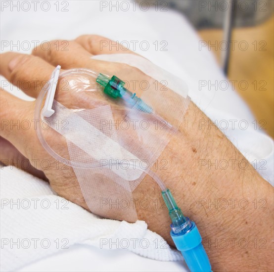 Close up of hand of elderly patient with IV drip attached.