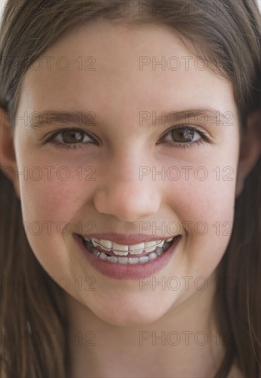 girl (10-11) wearing dental braces smiling.