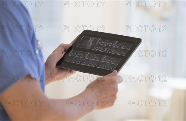 Man in scrubs watching ultrasound results on tablet.