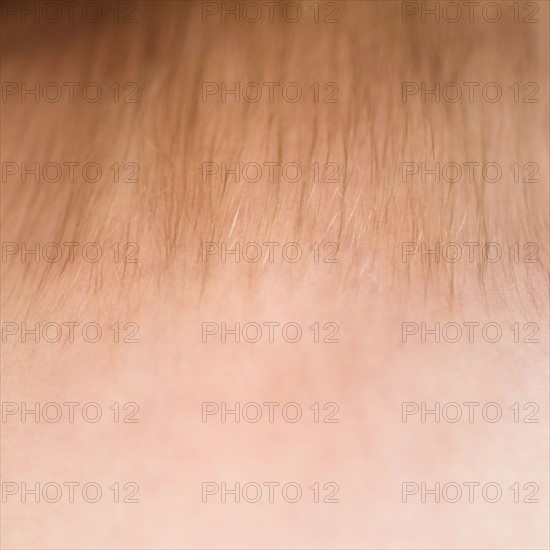 Close-up of baby boy's (2-5 months) forehead.