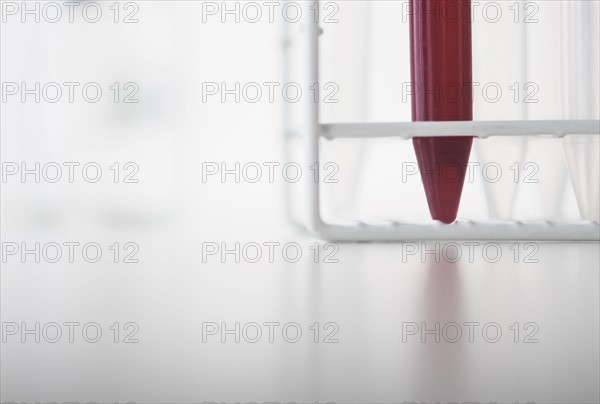 Blood sample in test tube.