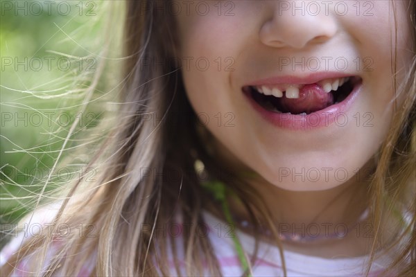 Girl with missing tooth