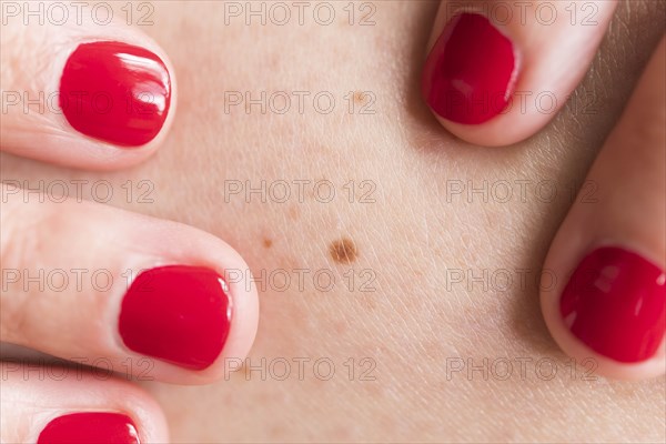 Close-up of woman wearing red nail polish touching skin with freckle
