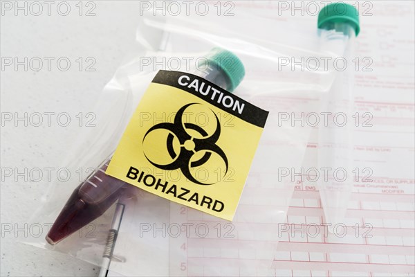 Blood sample with biohazard sign