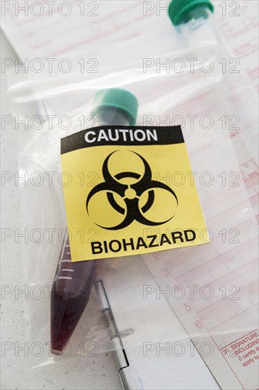 Blood sample with biohazard sign