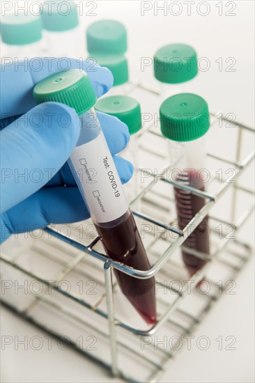 Close-up of hand in surgical glove holding blood sample