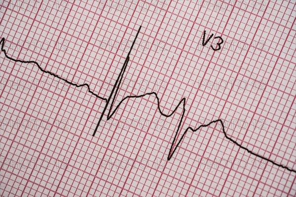 Electrocardiogram on red graph paper