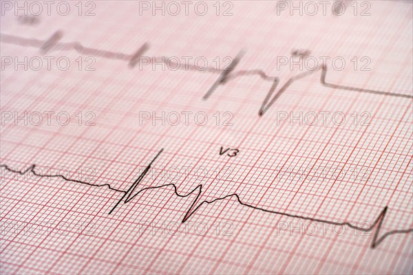 Electrocardiogram on red graph paper