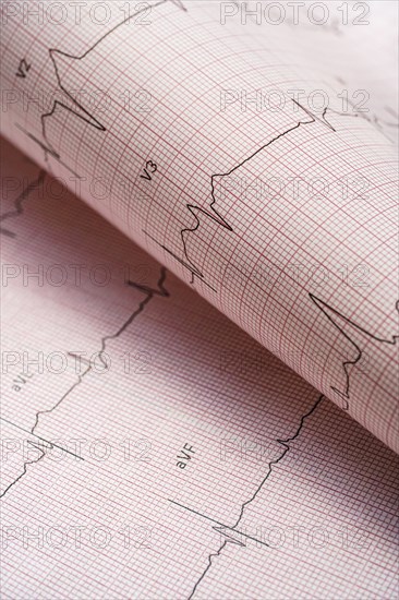Electrocardiogram on red graph paper