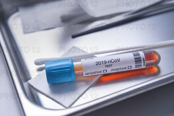 Test vial labelled 2019-nCoV on medical tray