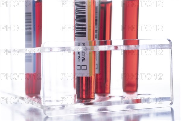 Studio shot of Covid-19 blood samples in test tube rack