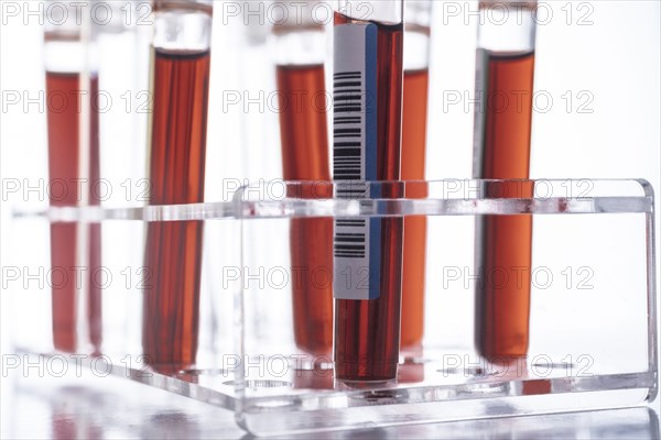 Studio shot of Covid-19 blood samples in test tube rack