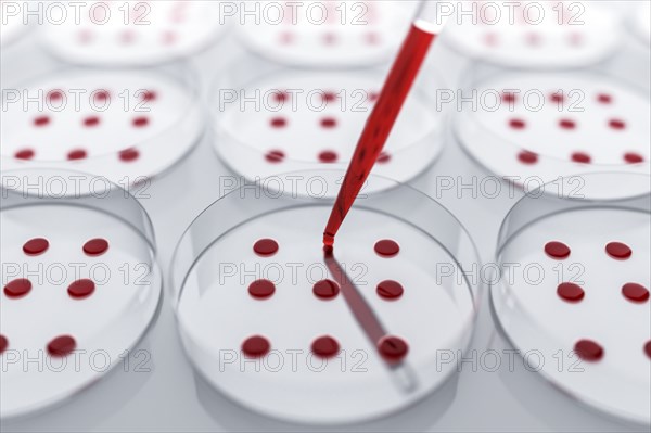 Blood sample tested on petri dish in laboratory