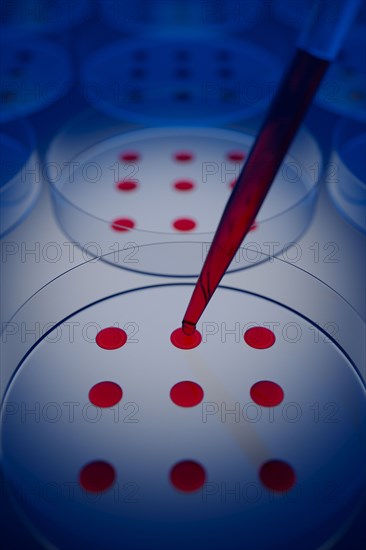 Blood sample tested on petri dish in laboratory