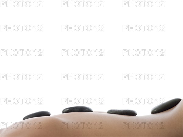 Close up of hot stones on back of woman