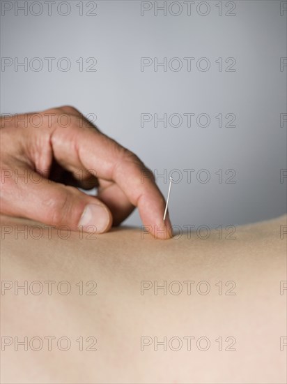 Close up of acupuncturist checking needle in back of patient