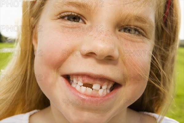 Grinning girl with tooth missing
