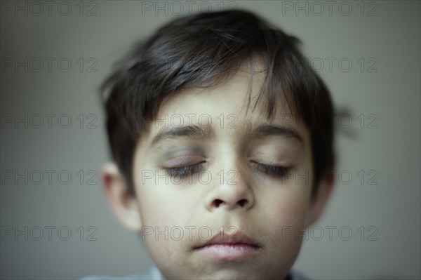 Mixed race boy with black eye