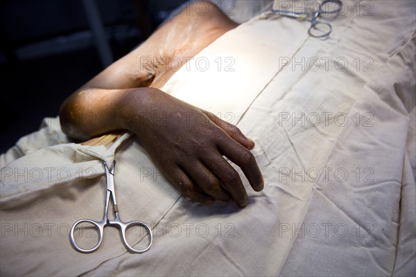 Close up of patient laying in surgery